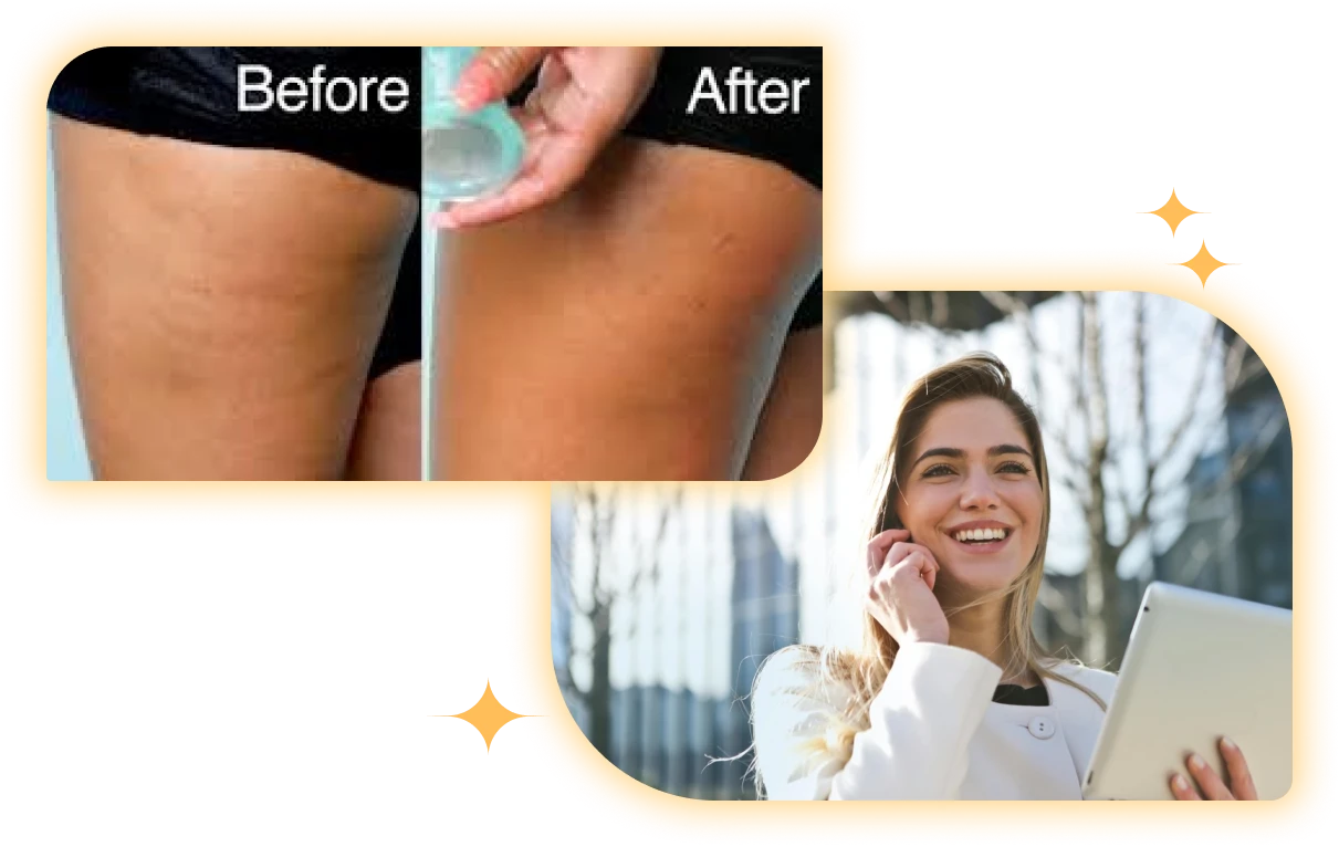 Best Cupping Massage at Eternal Experiences