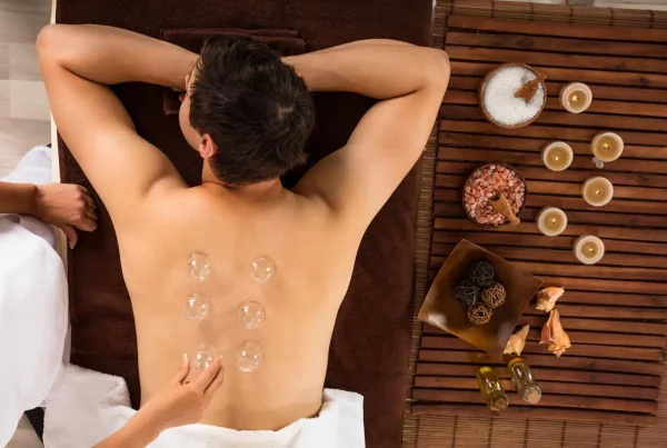 Best Cupping Therapy Near Me in Laval, QC