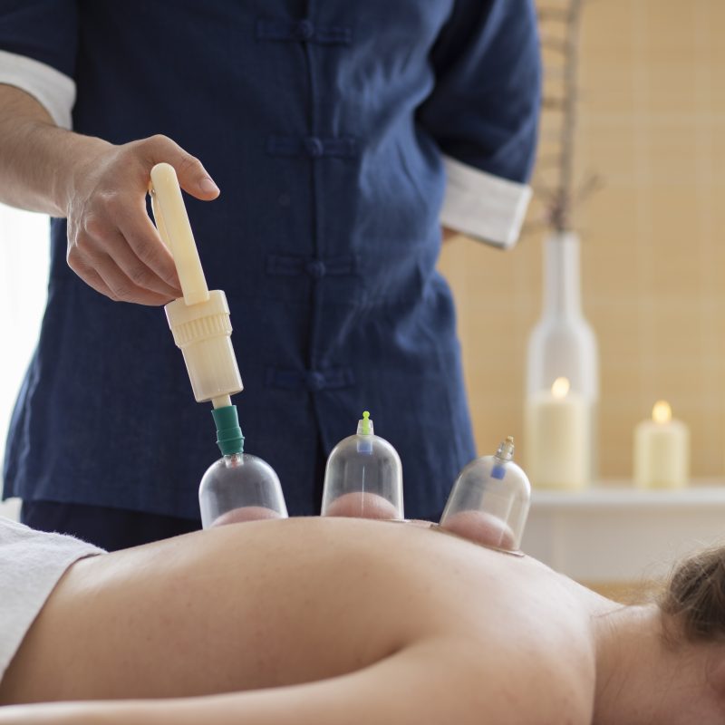 Best Cupping Therapy Near Me in Laval, QC
