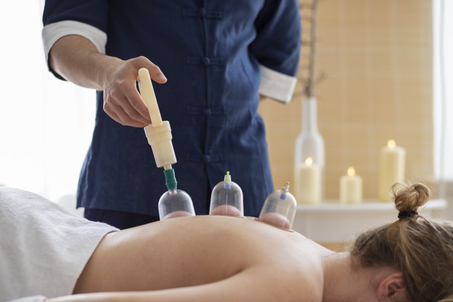 Best Cupping Therapy Near Me in Laval, QC