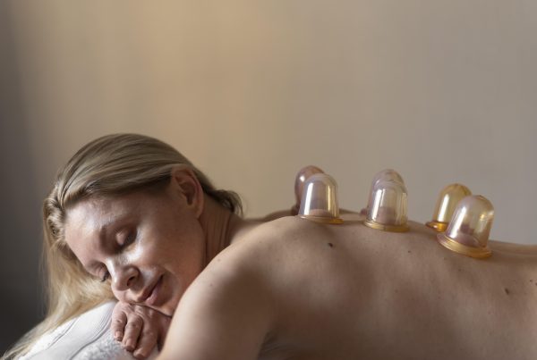 Cupping Therapy