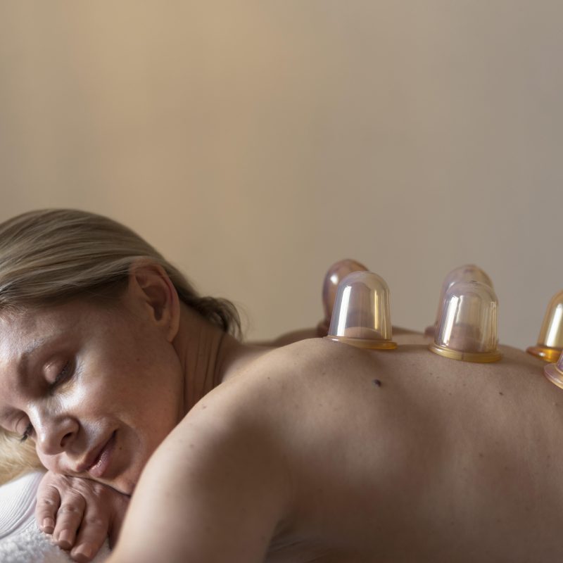 Cupping Therapy