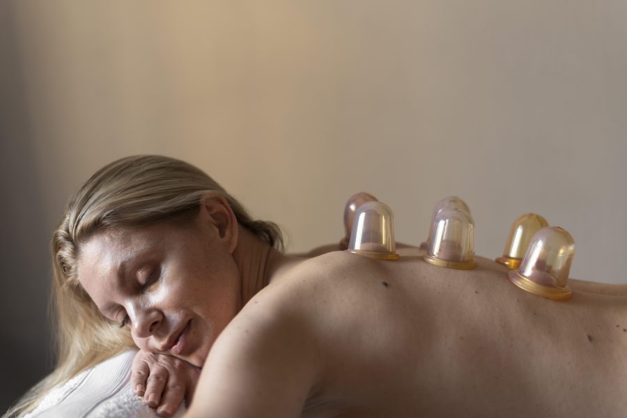 Cupping Therapy