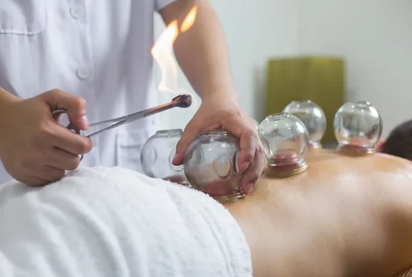 Cupping Therapy In Montreal, QC
