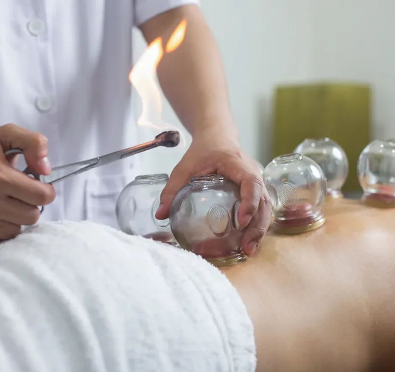 Cupping Therapy In Montreal, QC