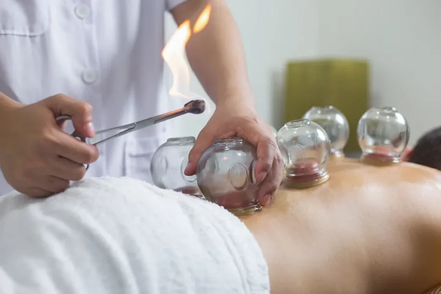 Cupping Therapy In Montreal, QC