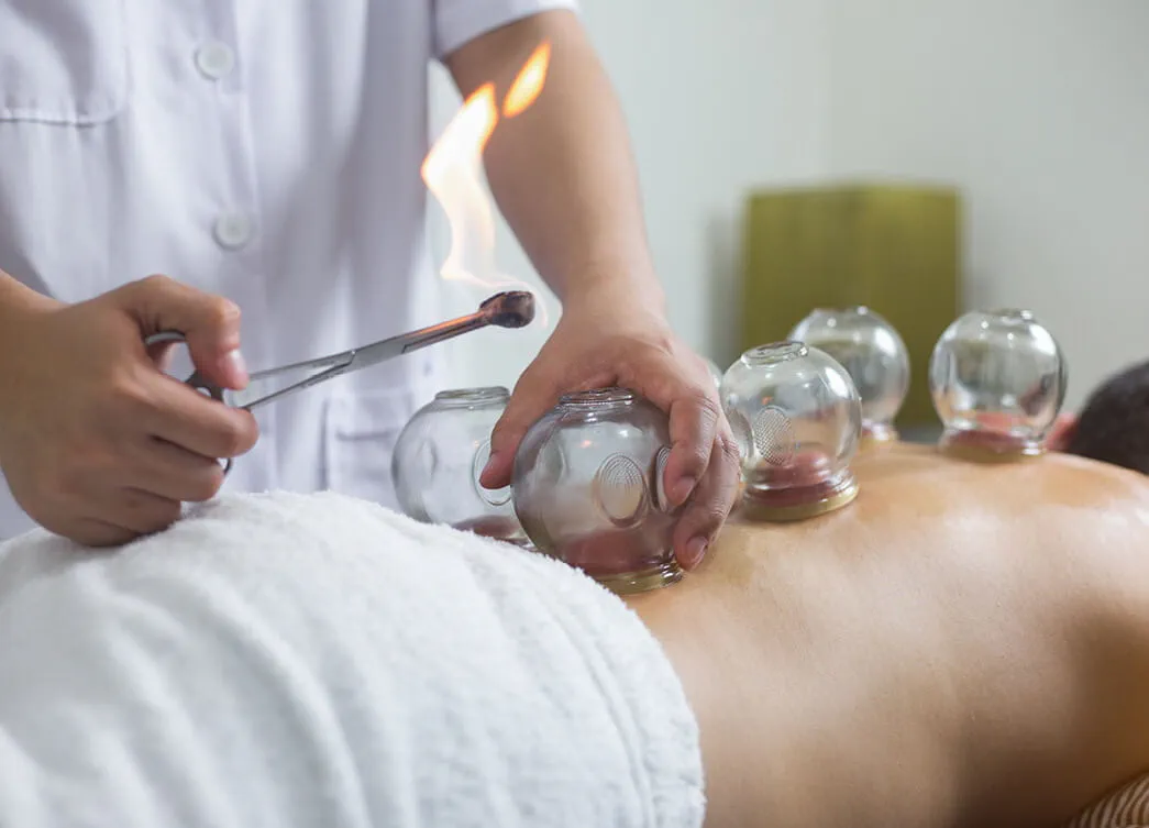 What Is Cupping Therapy?
