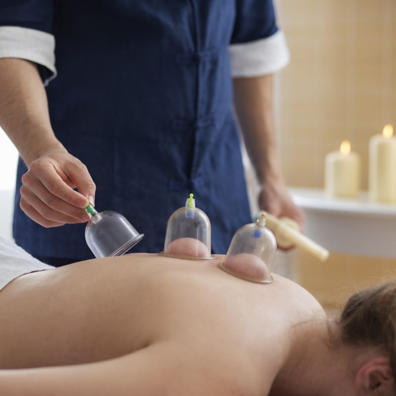 Cupping Therapy in Montreal, QC