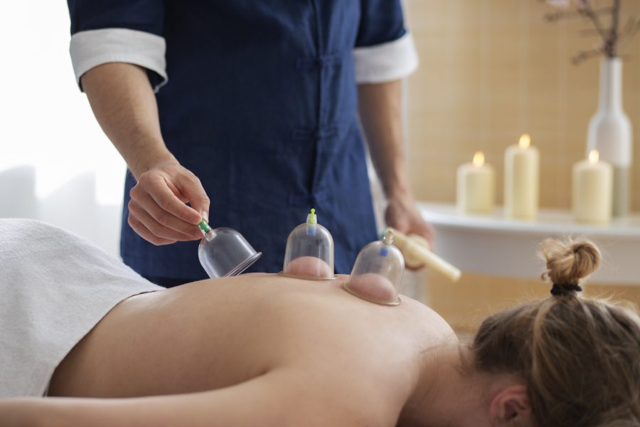 Cupping Therapy in Montreal, QC