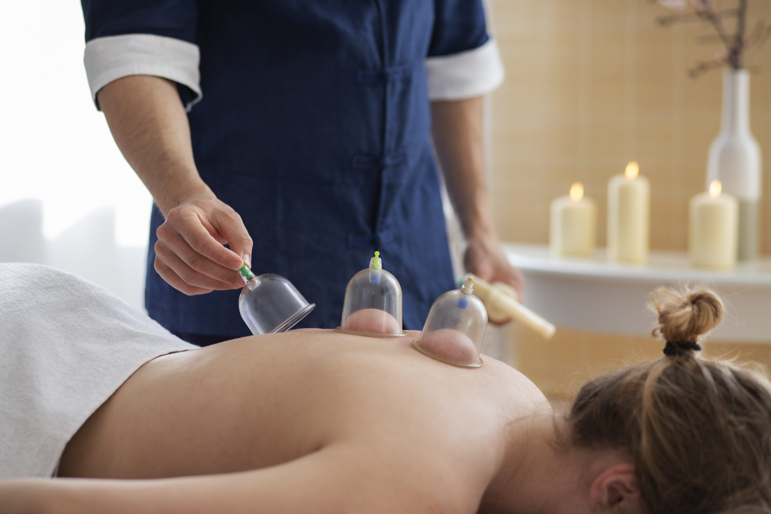 Does Cupping Therapy Really Work?